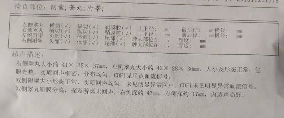 睾丸体检的重要性与必要性探究