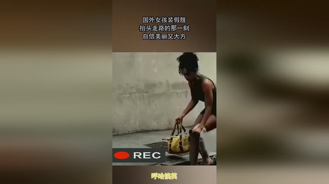 三岁假肢女童闪耀T台，自信征服全场目光